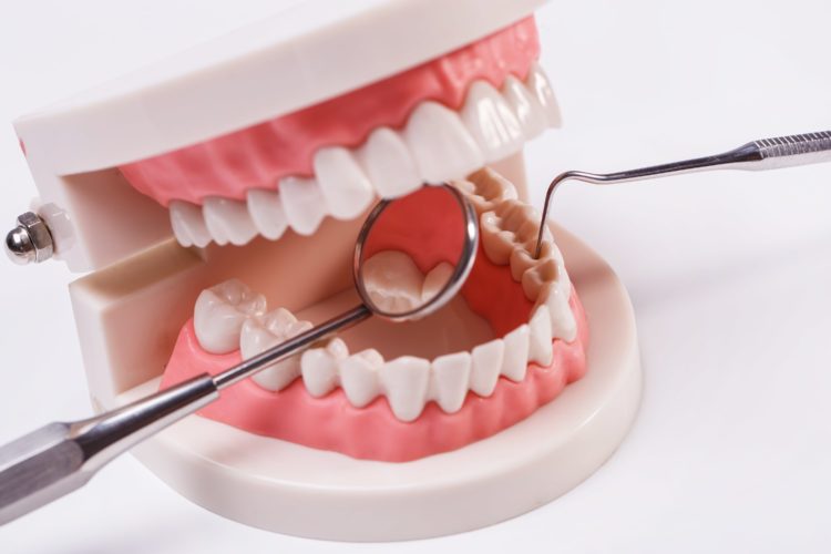 Dentures Everything you need to know