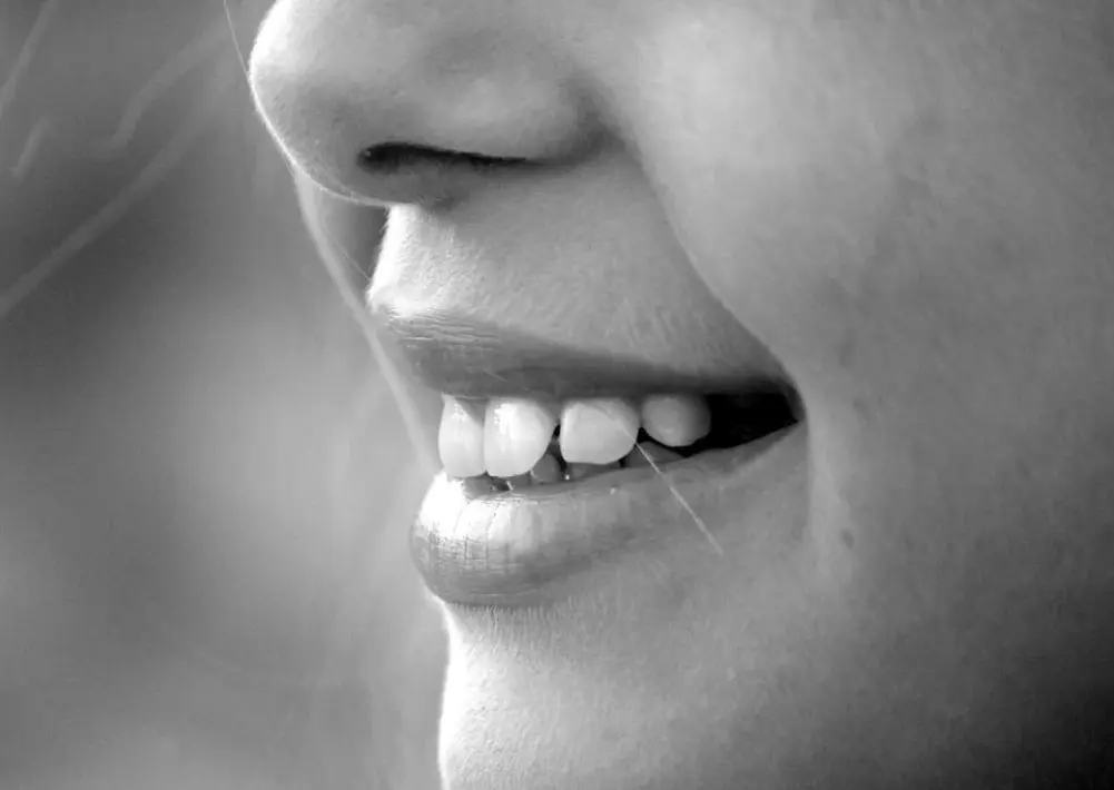 Girl smiling black and white photo of teeth