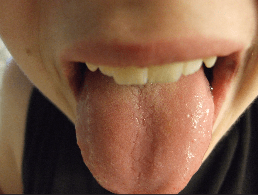 Healthy tongue example